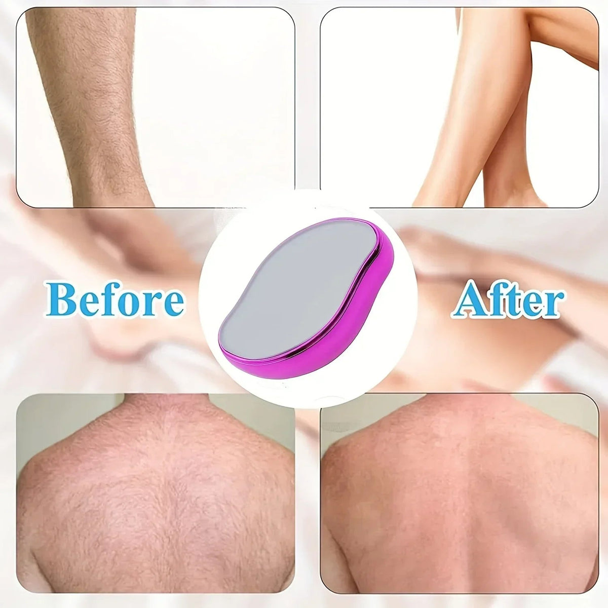 Crystal Hair Eraser – Gentle Epilation Tool Alsonic UK